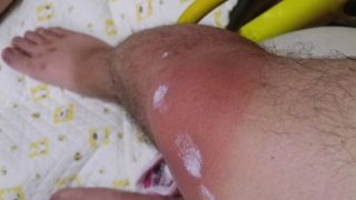 日焼け